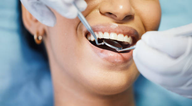 Best Emergency Cosmetic Dentistry in Riverton, WY